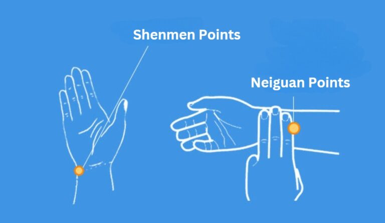 TMC Shenmen and Neiguan Points